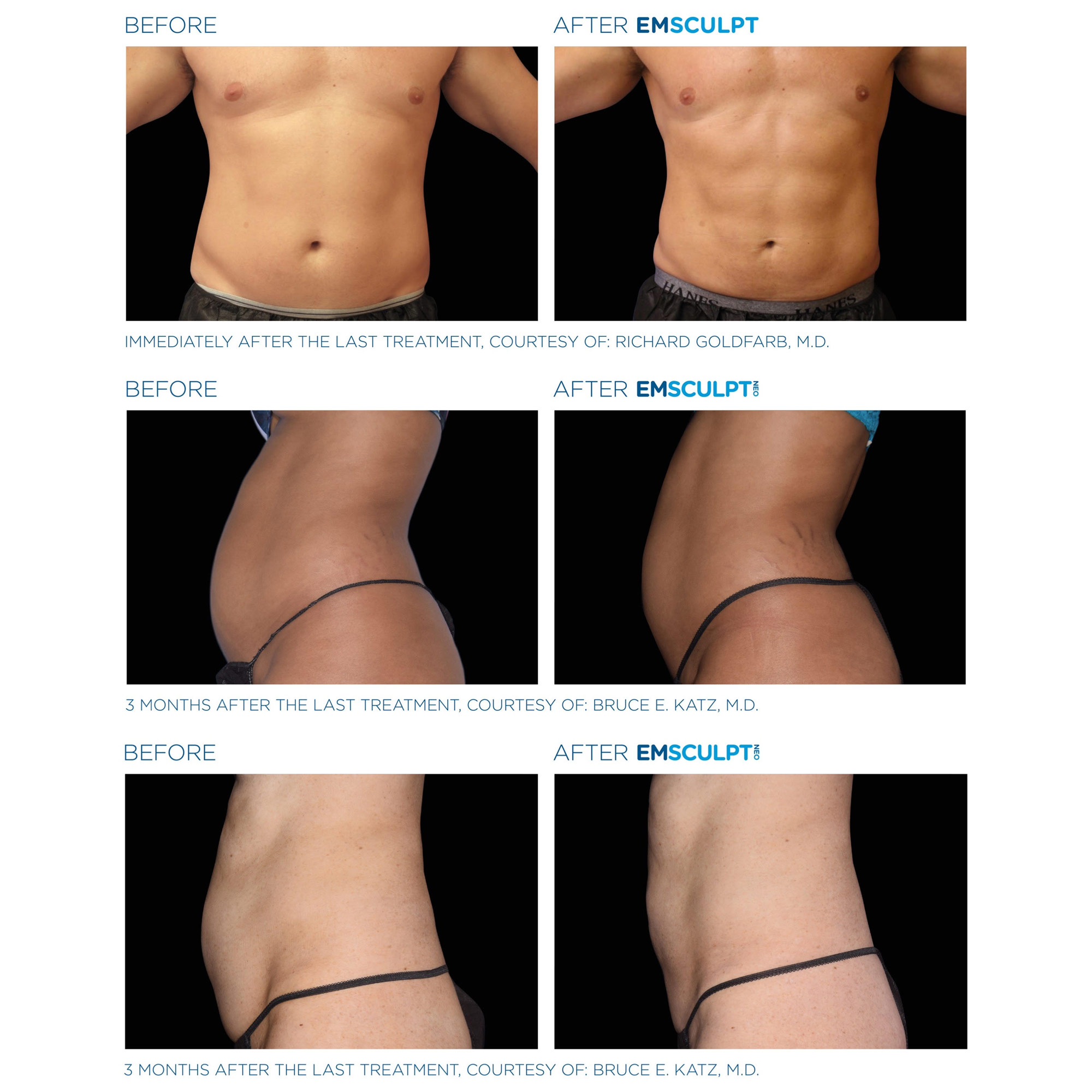 emsculpt fat reduction mumbai